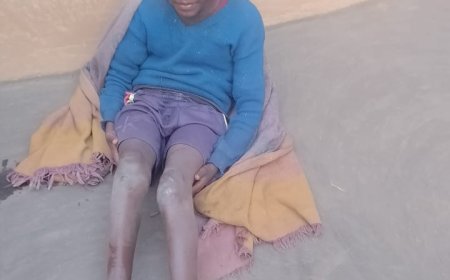 आठ वर्षीय आदिवासी बच्चा गंभीर बीमारी से जूझ रहा, सरकार से इलाज की गुहार